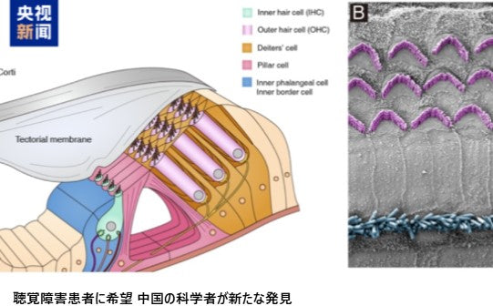聴覚障害患者に希望 中国の科学者が新たな発見