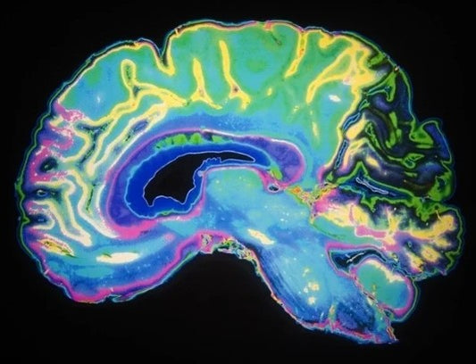 脳が聴覚と視覚の記憶を統合する仕組みを探る研究