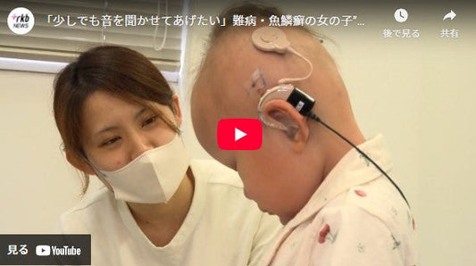 「少しでも音を聞かせてあげたい」難病・魚鱗癬の女の子”ちーちゃん”が人工内耳の手術 訪れた変化