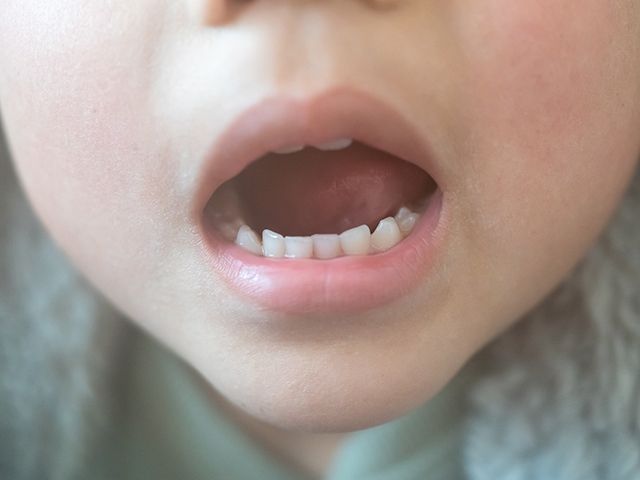 子どもの発音が気になったら? 言語聴覚士に聞く「構音障害」相談のタイミングとポイント