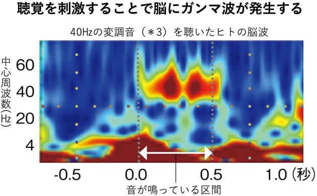 最新研究! 〝聴くこと〟で脳を刺激して、認知機能をキープする。