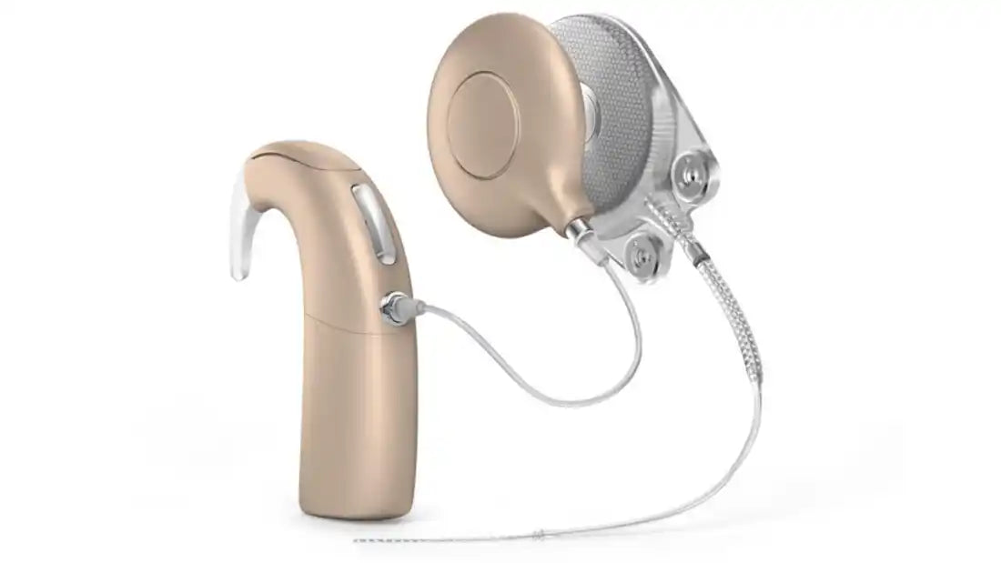 コクレア社、オーティコンメディカル社のニューロ人工内耳事業を買収 – Love My Hearing