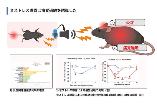 「痛み」は音で伝搬する 〜痛みが増す原因は他者の痛がる声にあった〜