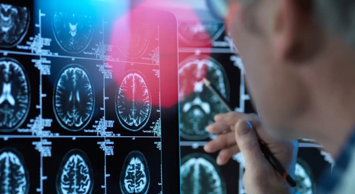 「視力検査」が認知症の予防に？中年期は「難聴」に注意：最新「脳を健康に保つ」コツ #専門家のまとめ