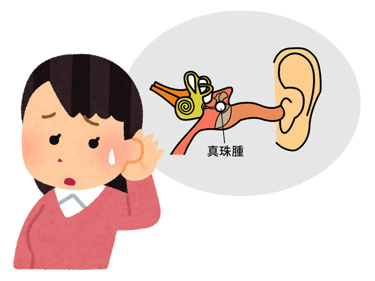 難治性の慢性中耳炎、急性白血病治療薬が効く可能性 慈恵医大が発見