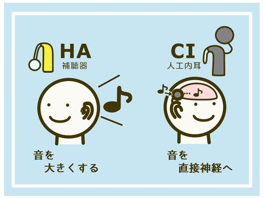 人工内耳と補聴器、どのような基準で選べばよいですか？