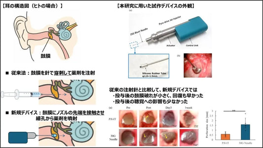 当社の針なしジェットインジェクション技術を用いた内耳疾患治療応用に関する研究