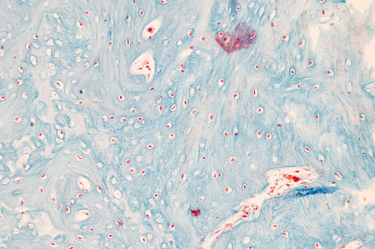 難聴治療にAAV技術を用いた新しいCLIC5遺伝子治療