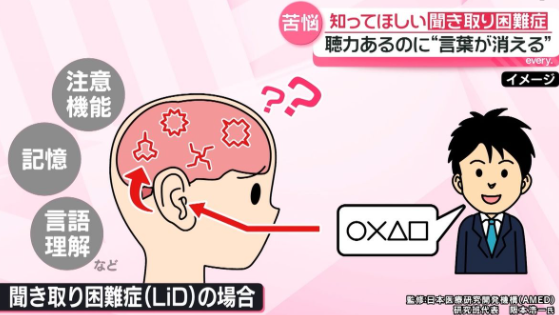 聴力あるのに“言葉が消える”──100人に1人が「聞き取り困難症」？　「何が何だか分からない」…診断前の苦悩『every.特集』