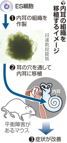 めまい・ふらつきなど治療困難な平衡障害、ＥＳ細胞から作った内耳組織の移植で改善…京大などマウスで確認