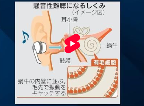 YouTubeの画面「【回復難しい「イヤホン難聴」予防が肝心】騒音性難聴で失われた聴力は戻らないリスクがあります。」