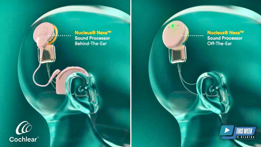 Cochlear Nucleus Nexaインプラントシステム：イノベーションによる聴覚成果の向上