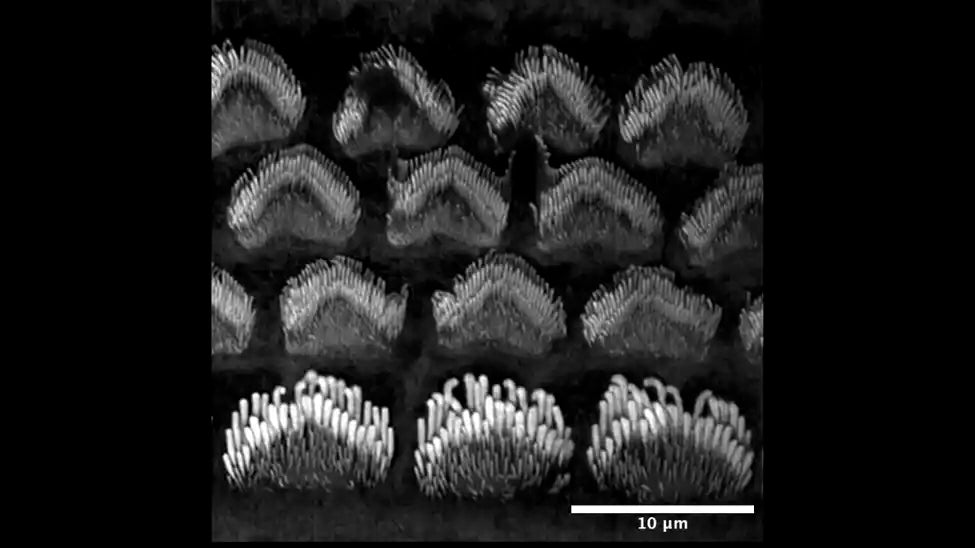 聴覚に関わる主要タンパク質の新たな役割が、永久的な難聴の原因となる可能性