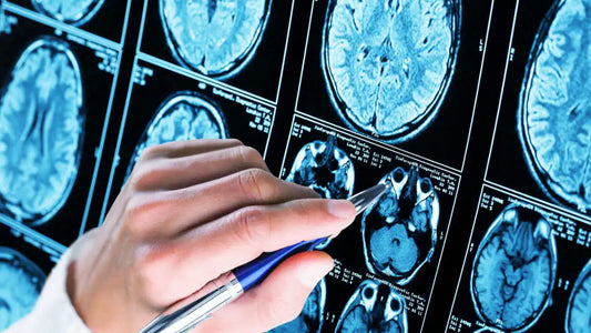 研究：補聴器の処方は認知機能の向上にはつながらないが、認知症リスクは低下する