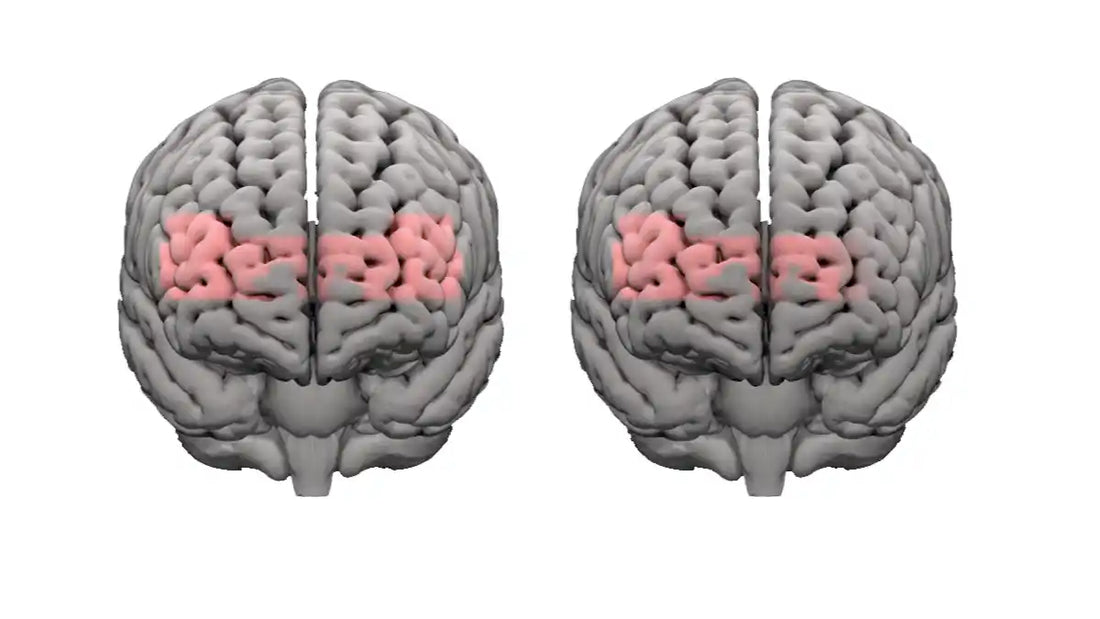 フォナック インフィニオ スフィアは、騒音下での聴取時の認知的負担を軽減します