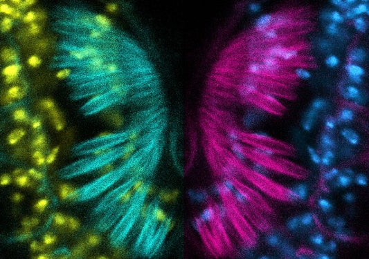 シカゴ大学の科学者らが難聴に関連する遺伝子変異を発見し、治療法の可能性も特定