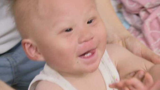 「天使の子」ちーちゃんの病気は100万人に1人の難病「KID症候群」　母は”最初は受け止められるか怖かった”