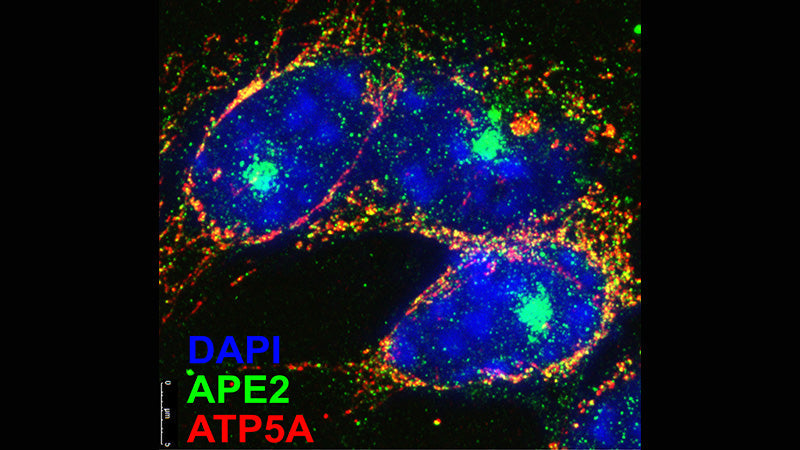 化学療法薬シスプラチンが難聴を引き起こす仕組みを研究が明らかに