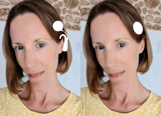 私の難聴の物語「突発性感音難聴の体験とそれが私の人生に及ぼす影響。」